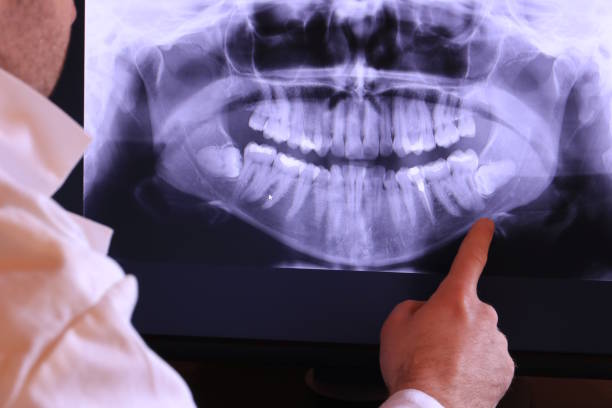 Best Emergency Treatment for Oral Infections in Spencer, OK