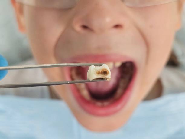 Professional Emergency Dental Service in OK
